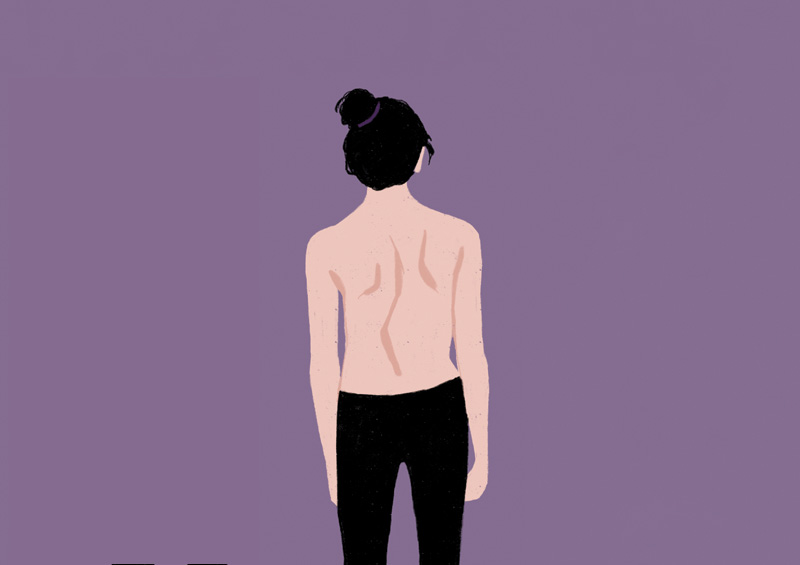 About Scoliosis